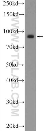 Importin beta Antibody in Western Blot (WB)