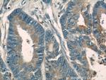 PKM Antibody in Immunohistochemistry (Paraffin) (IHC (P))