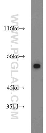 PKM Antibody in Western Blot (WB)