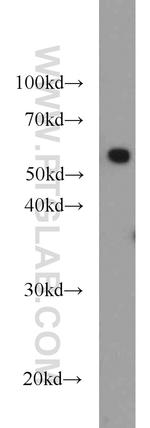 PKM Antibody in Western Blot (WB)