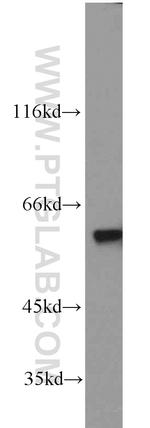 PKM Antibody in Western Blot (WB)