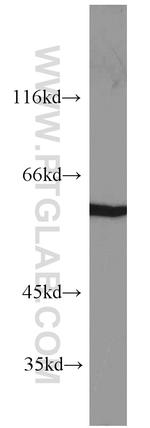 PKM Antibody in Western Blot (WB)