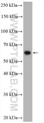 PKM Antibody in Western Blot (WB)