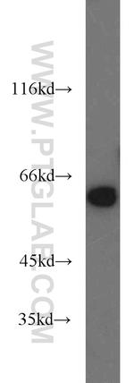 PKM Antibody in Western Blot (WB)