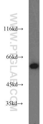 PKM Antibody in Western Blot (WB)