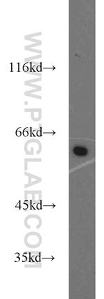 PKM Antibody in Western Blot (WB)