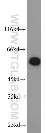 PKM Antibody in Western Blot (WB)