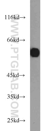 PKM Antibody in Western Blot (WB)