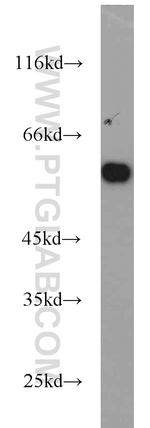 PKM Antibody in Western Blot (WB)