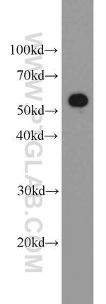 PKM Antibody in Western Blot (WB)