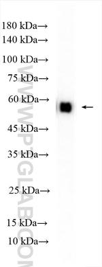 PKM Antibody in Western Blot (WB)