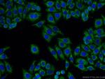 GNB3 Antibody in Immunocytochemistry (ICC/IF)