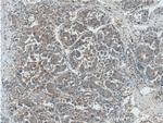 GNB3 Antibody in Immunohistochemistry (Paraffin) (IHC (P))