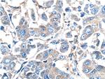 GNB3 Antibody in Immunohistochemistry (Paraffin) (IHC (P))