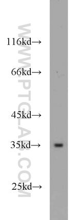 GNB3 Antibody in Western Blot (WB)