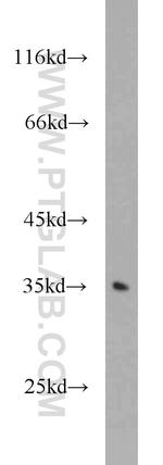 GNB3 Antibody in Western Blot (WB)