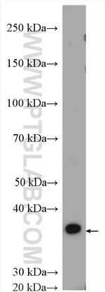 GNB3 Antibody in Western Blot (WB)