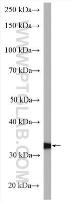 GNB3 Antibody in Western Blot (WB)