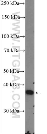 GNB3 Antibody in Western Blot (WB)