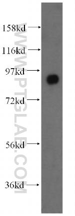 CD71 Antibody in Western Blot (WB)