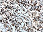 CD71 Antibody in Immunohistochemistry (Paraffin) (IHC (P))