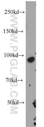 CD71 Antibody in Western Blot (WB)