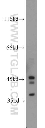 PAFAH2 Antibody in Western Blot (WB)