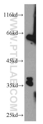 Annexin IV Antibody in Western Blot (WB)