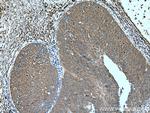 ATG7 Antibody in Immunohistochemistry (Paraffin) (IHC (P))