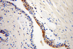 ARL2BP Antibody in Immunohistochemistry (Paraffin) (IHC (P))