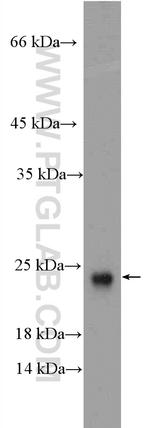 ARL2BP Antibody in Western Blot (WB)