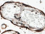 NOB1 Antibody in Immunohistochemistry (Paraffin) (IHC (P))