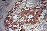 NOB1 Antibody in Immunohistochemistry (Paraffin) (IHC (P))