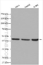 NOB1 Antibody in Western Blot (WB)