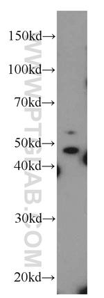 NOB1 Antibody in Western Blot (WB)