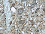 beta Tubulin Antibody in Immunohistochemistry (Paraffin) (IHC (P))