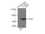 beta Tubulin Antibody in Immunoprecipitation (IP)