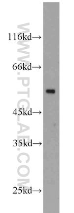 beta Tubulin Antibody in Western Blot (WB)