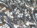 beta Tubulin Antibody in Immunohistochemistry (Paraffin) (IHC (P))