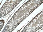 beta Tubulin Antibody in Immunohistochemistry (Paraffin) (IHC (P))