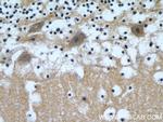 beta Tubulin Antibody in Immunohistochemistry (Paraffin) (IHC (P))