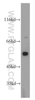 beta Tubulin Antibody in Western Blot (WB)