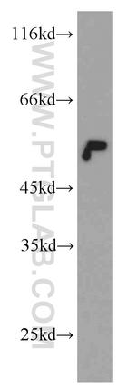 beta Tubulin Antibody in Western Blot (WB)