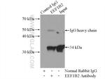 EEF1B2 Antibody in Immunoprecipitation (IP)