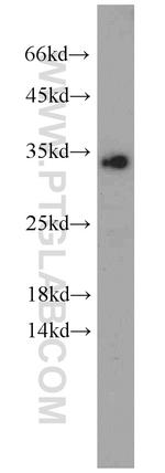 EEF1B2 Antibody in Western Blot (WB)