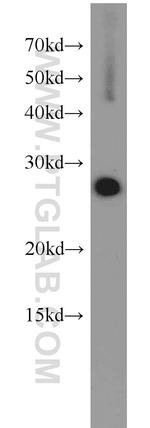 EEF1B2 Antibody in Western Blot (WB)