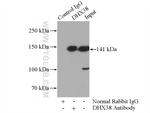 DHX38 Antibody in Immunoprecipitation (IP)