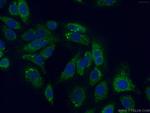 PITRM1 Antibody in Immunocytochemistry (ICC/IF)