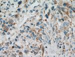 PITRM1 Antibody in Immunohistochemistry (Paraffin) (IHC (P))