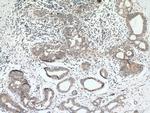 PITRM1 Antibody in Immunohistochemistry (Paraffin) (IHC (P))